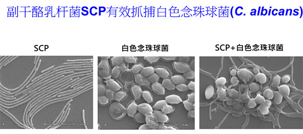 景岳副干酪乳杆菌SCP有效防治念珠菌